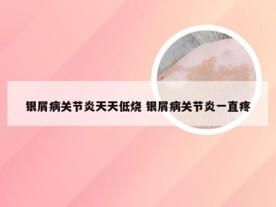 银屑病关节炎天天低烧 银屑病关节炎一直疼