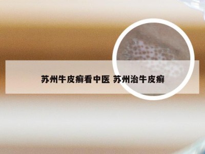 苏州牛皮癣看中医 苏州治牛皮癣