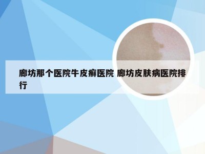 廊坊那个医院牛皮癣医院 廊坊皮肤病医院排行