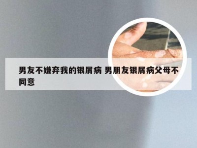 男友不嫌弃我的银屑病 男朋友银屑病父母不同意