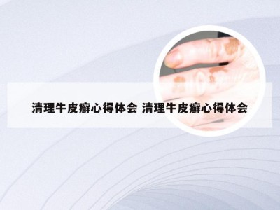 清理牛皮癣心得体会 清理牛皮癣心得体会