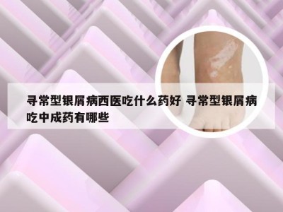 寻常型银屑病西医吃什么药好 寻常型银屑病吃中成药有哪些