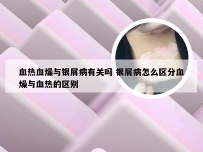 血热血燥与银屑病有关吗 银屑病怎么区分血燥与血热的区别