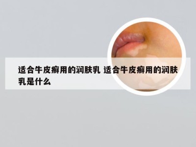 适合牛皮癣用的润肤乳 适合牛皮癣用的润肤乳是什么