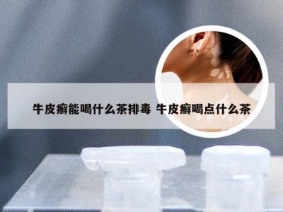 牛皮癣能喝什么茶排毒 牛皮癣喝点什么茶