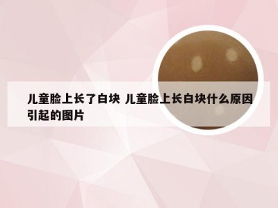 儿童脸上长了白块 儿童脸上长白块什么原因引起的图片