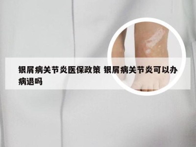 银屑病关节炎医保政策 银屑病关节炎可以办病退吗