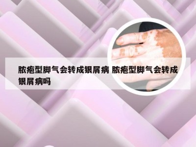 脓疱型脚气会转成银屑病 脓疱型脚气会转成银屑病吗