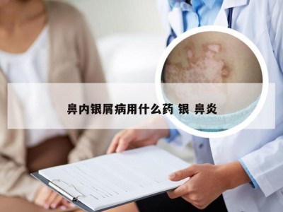 鼻内银屑病用什么药 银 鼻炎
