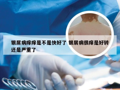 银屑病痒痒是不是快好了 银屑病很痒是好转还是严重了