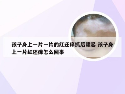 孩子身上一片一片的红还痒抓后隆起 孩子身上一片红还痒怎么回事