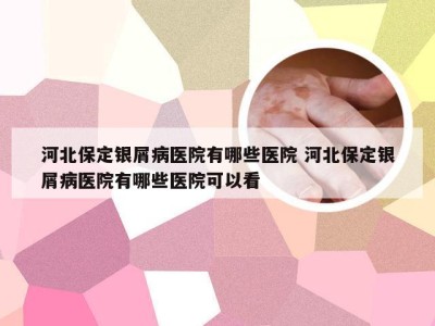 河北保定银屑病医院有哪些医院 河北保定银屑病医院有哪些医院可以看