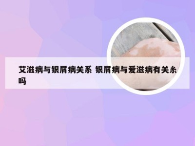 艾滋病与银屑病关系 银屑病与爱滋病有关糸吗