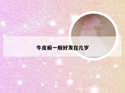 牛皮癣一般好发在几岁