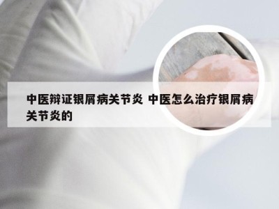 中医辩证银屑病关节炎 中医怎么治疗银屑病关节炎的