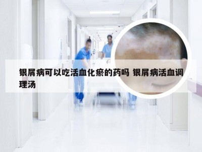 银屑病可以吃活血化瘀的药吗 银屑病活血调理汤