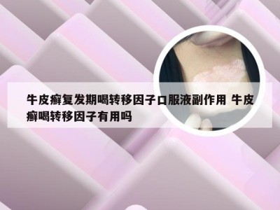 牛皮癣复发期喝转移因子口服液副作用 牛皮癣喝转移因子有用吗