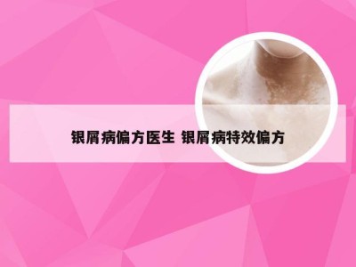 银屑病偏方医生 银屑病特效偏方