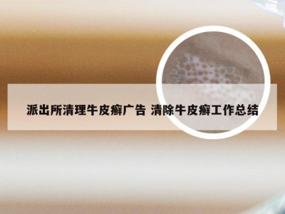 派出所清理牛皮癣广告 清除牛皮癣工作总结