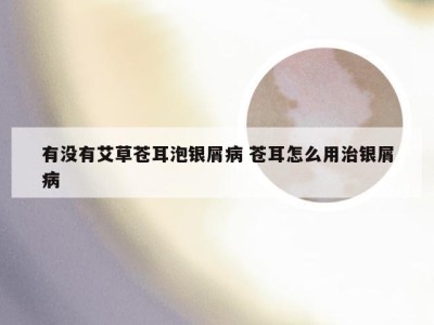 有没有艾草苍耳泡银屑病 苍耳怎么用治银屑病