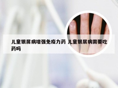 儿童银屑病增强免疫力药 儿童银屑病需要吃药吗