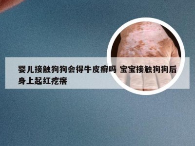 婴儿接触狗狗会得牛皮癣吗 宝宝接触狗狗后身上起红疙瘩