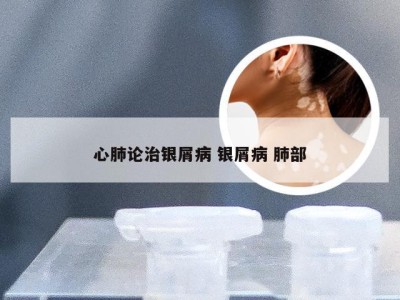 心肺论治银屑病 银屑病 肺部