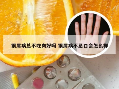 银屑病总不吃肉好吗 银屑病不忌口会怎么样