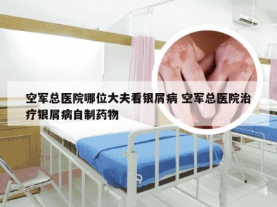 空军总医院哪位大夫看银屑病 空军总医院治疗银屑病自制药物