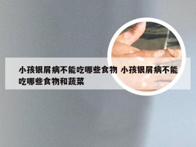 小孩银屑病不能吃哪些食物 小孩银屑病不能吃哪些食物和蔬菜
