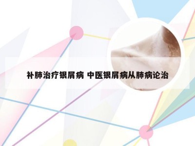 补肺治疗银屑病 中医银屑病从肺病论治