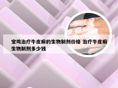 宝鸡治疗牛皮癣的生物制剂价格 治疗牛皮癣生物制剂多少钱