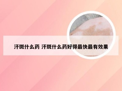 汗斑什么药 汗斑什么药好得最快最有效果