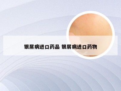 银屑病进口药品 银屑病进口药物