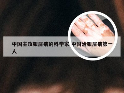 中国主攻银屑病的科学家 中国治银屑病第一人