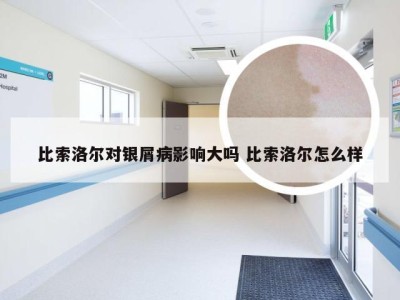 比索洛尔对银屑病影响大吗 比索洛尔怎么样