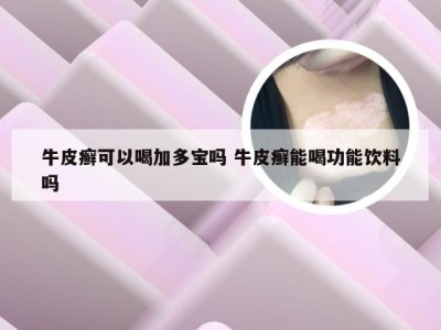 牛皮癣可以喝加多宝吗 牛皮癣能喝功能饮料吗