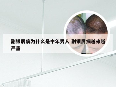 副银屑病为什么是中年男人 副银屑病越来越严重