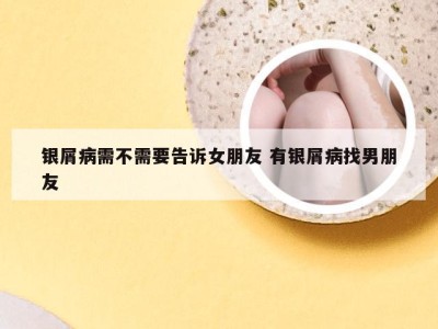 银屑病需不需要告诉女朋友 有银屑病找男朋友