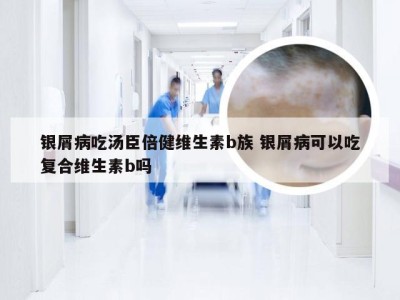 银屑病吃汤臣倍健维生素b族 银屑病可以吃复合维生素b吗