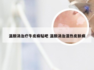 温胆汤治疗牛皮癣贴吧 温胆汤治湿热皮肤病