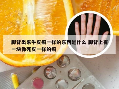脚背出来牛皮癣一样的东西是什么 脚背上有一块像死皮一样的癣