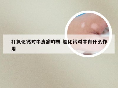 打氯化钙对牛皮癣咋样 氯化钙对牛有什么作用
