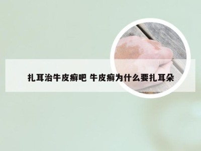 扎耳治牛皮癣吧 牛皮癣为什么要扎耳朵