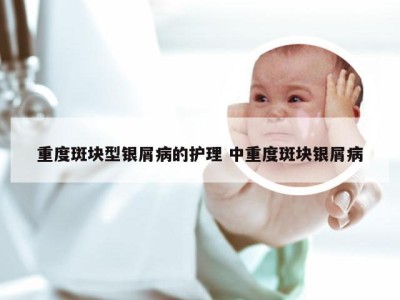 重度斑块型银屑病的护理 中重度斑块银屑病