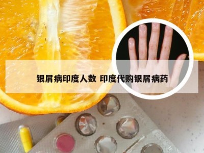 银屑病印度人数 印度代购银屑病药