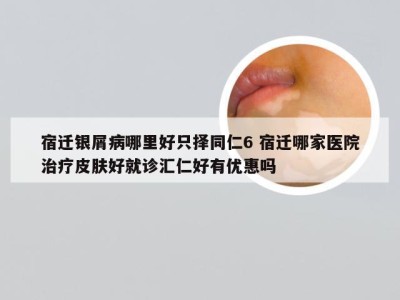 宿迁银屑病哪里好只择同仁6 宿迁哪家医院治疗皮肤好就诊汇仁好有优惠吗