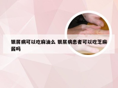 银屑病可以吃麻油么 银屑病患者可以吃芝麻酱吗