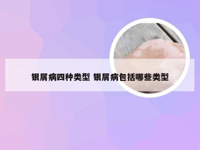 银屑病四种类型 银屑病包括哪些类型