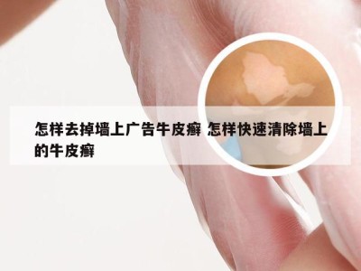 怎样去掉墙上广告牛皮癣 怎样快速清除墙上的牛皮癣